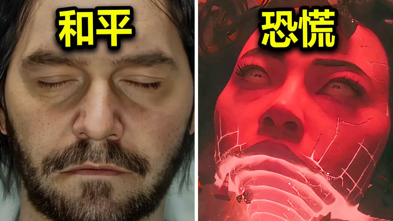 Beheer Resonant Gedetailleerde Voorskou Vrygestel